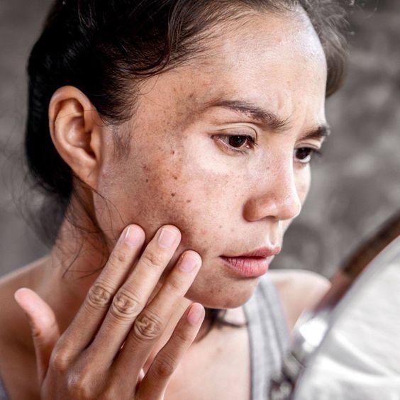 Cảnh báo: Bổ sung collagen sai thời điểm, da không căng trẻ mà còn lão hóa nhanh- Ảnh 3.