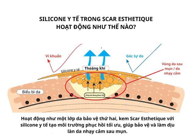 Da sau mụn: Giải mã tiến trình phục hồi sinh học dưới góc độ chuyên gia- Ảnh 3. Da sau mụn: Giải mã tiến trình phục hồi sinh học dưới góc độ chuyên gia- Ảnh 3.