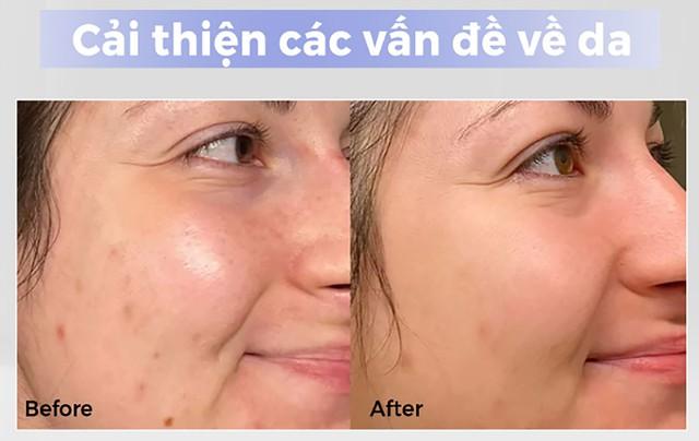 Top 8 kem trắng da chống lão hóa đang được chị em 'săn lùng' trước Tết - Ảnh 5.