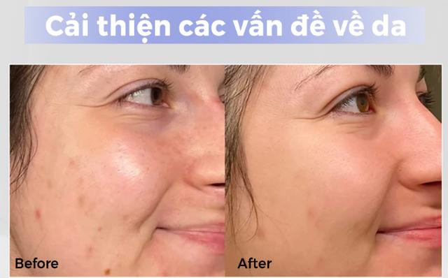 Chị em U30+ cứ ngỡ 20 nhờ top 6 kem dưỡng da, vừa kịp đón Tết 2026 - Ảnh 7.