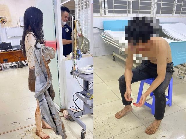 Giải cứu thành công 2 bạn trẻ rơi xuống giếng hoang ở Long Khánh- Ảnh 2. Giải cứu thành công 2 bạn trẻ rơi xuống giếng hoang ở Long Khánh- Ảnh 2.