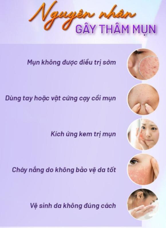 Làm đẹp da láng mịn không thâm mụn Nhờ skincare chuẩn y khoa tại nhà - Ảnh 4.