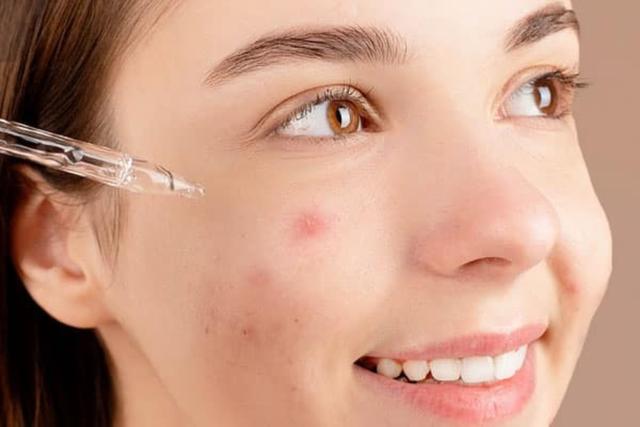 Làm đẹp da láng mịn không thâm mụn Nhờ skincare chuẩn y khoa tại nhà - Ảnh 7.