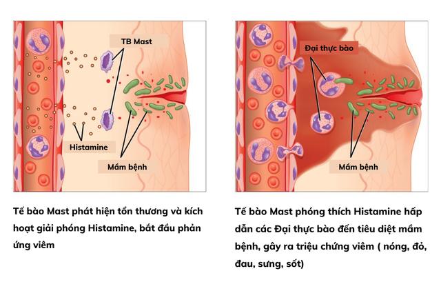 Kiểm soát viêm sớm - Nền tảng khoa học trong phòng ngừa sẹo hậu phẫu - Ảnh 2.
