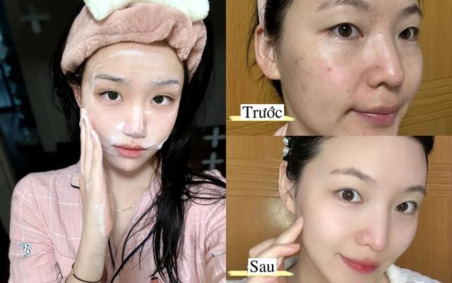 Top 7 sữa rửa mặt cho da dầu mụn sạch sâu, giảm bóng nhờn dù đang hè - Ảnh 1.