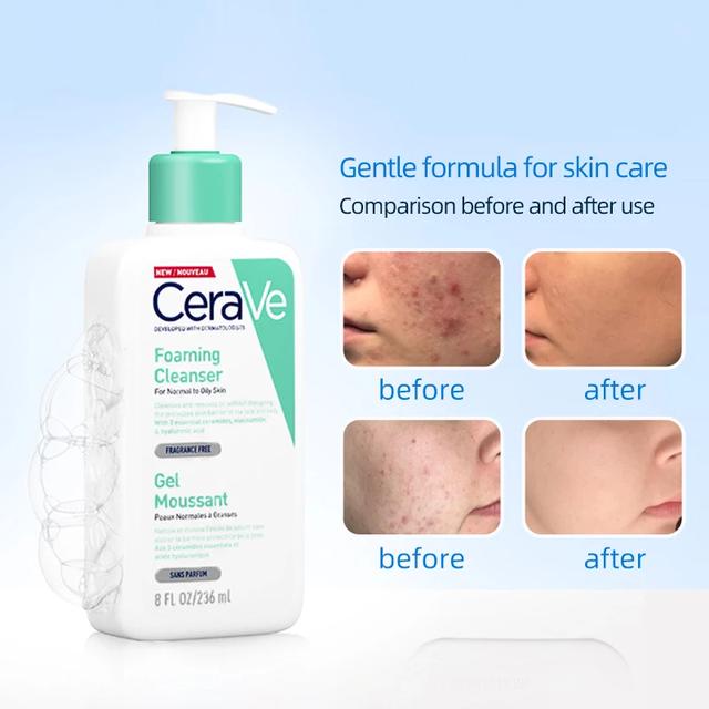 Top 7 sữa rửa mặt cho da dầu mụn sạch sâu, giảm bóng nhờn dù đang hè - Ảnh 6.
