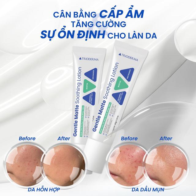 Giữa muôn vàn loại dưỡng ẩm, đâu là ‘texture chân ái’ dành cho da dầu mụn - Ảnh 7.