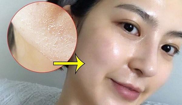 Top 6 sữa rửa mặt cho da khô ráp, nứt nẻ cũng trở nên mềm mịn - Ảnh 1.