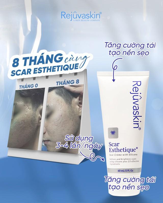 Review kem làm mờ sẹo rỗ do mụn Scar Esthetique với lượt bán top đầu trên TikTok? - Ảnh 1.