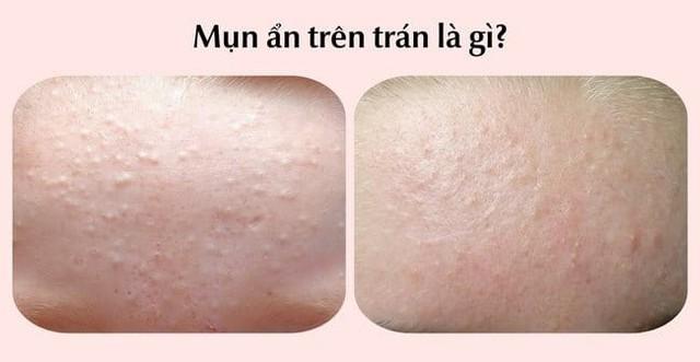 Kem chấm mụn trên trán nào có lượt bán top đầu TikTok hiện nay?- Ảnh 2. Kem chấm mụn trên trán nào có lượt bán top đầu TikTok hiện nay?- Ảnh 2.