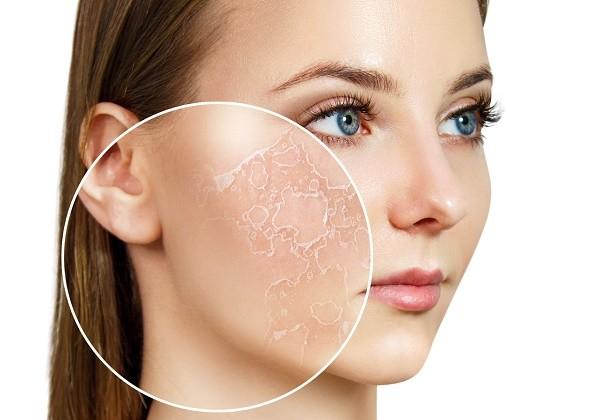 Cảnh báo: 5 dấu hiệu da thiếu collagen ‘trầm trọng’ mà 99% chị em đều bỏ qua- Ảnh 3. Cảnh báo: 5 dấu hiệu da thiếu collagen ‘trầm trọng’ mà 99% chị em đều bỏ qua- Ảnh 3.