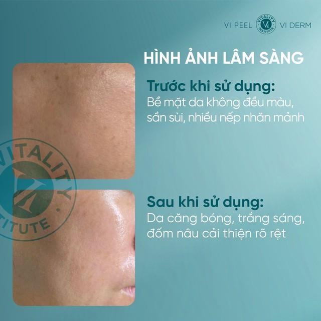 Tưởng filter, ai ngờ U40 trẻ như 20 nhờ 3 kem trắng da chống lão hóa này!- Ảnh 3.