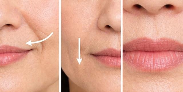 Cảnh báo: 5 dấu hiệu da thiếu collagen ‘trầm trọng’ mà 99% chị em đều bỏ qua- Ảnh 4. Cảnh báo: 5 dấu hiệu da thiếu collagen ‘trầm trọng’ mà 99% chị em đều bỏ qua- Ảnh 4.