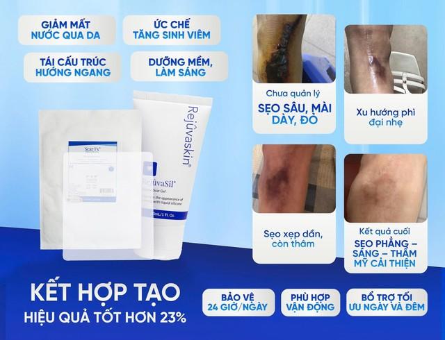 Sẹo mới: Cách xử lý hiệu quả với Scar FX và Rejuvasil Silicone Gel - Ảnh 4.