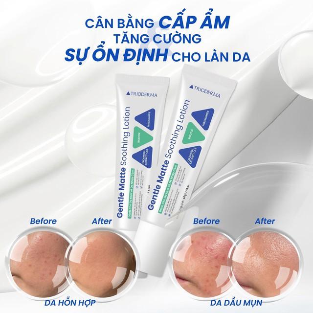 Hướng dẫn sử dụng lotion làm khỏe da Trioderrma Gentle Matte Soothing Lotion chuẩn y khoa - Ảnh 5.