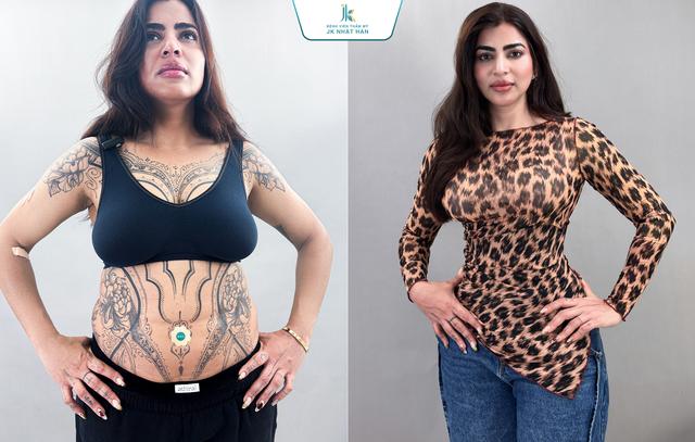 BS Lê Phước Tiền và xu hướng tạo hình vóc dáng chuẩn quốc tế - Ảnh 5.