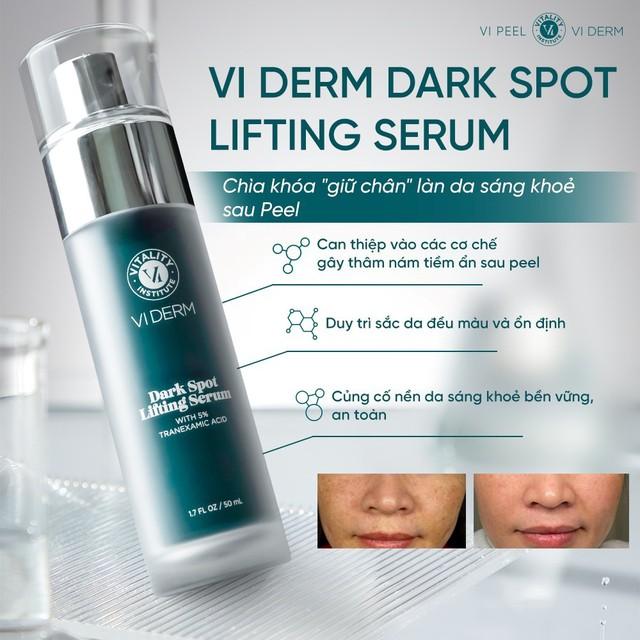 5 kem giúp mờ nám da trắng sáng sau khoảng 4 tuần, kể cả nám hỗn hợp - Ảnh 9.