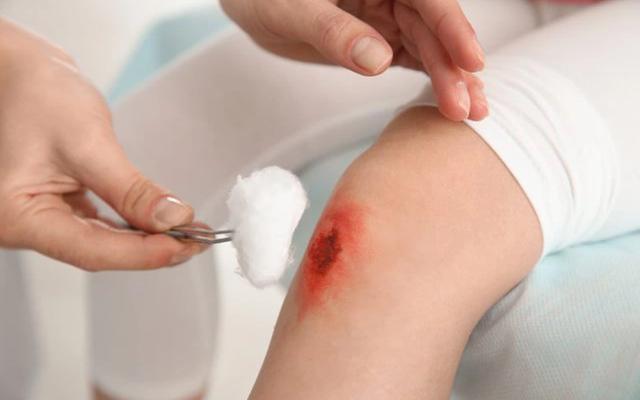 Cách dùng kem bôi vết thương hở tưởng đơn giản nhưng nhiều người vẫn làm sai - Ảnh 7.