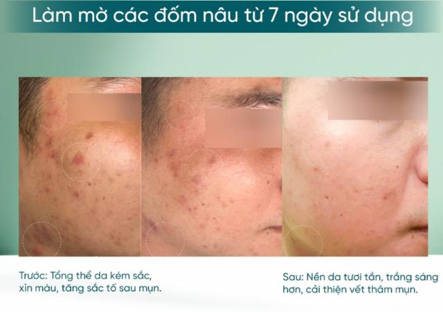Lưu ngay 5 serum chống lão hóa 'bơm đầy' collagen, da căng bóng chẳng cần tiêm filler- Ảnh 3.