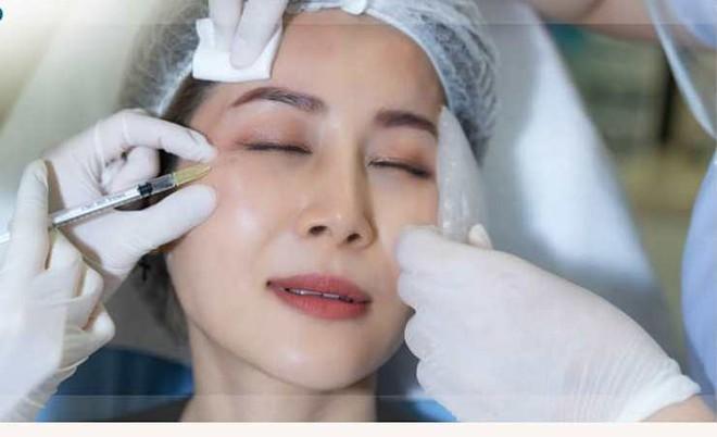 Bí mật đằng sau bọng mắt và quầng thâm đen dưới mắt- Ảnh 4. Bí mật đằng sau bọng mắt và quầng thâm đen dưới mắt- Ảnh 4.
