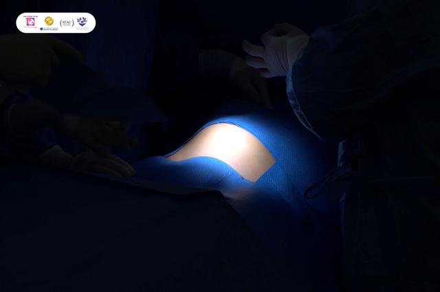 Khách hàng quốc tế an tâm điều trị khối đa nhân xơ lớn tại BV Phương Nam- Ảnh 1.