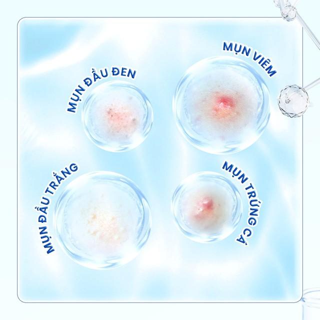 Kem giúp ngừa mụn đầu đen cực đỉnh: Mũi sạch bong, căng bóng như vừa đi spa - Ảnh 10.