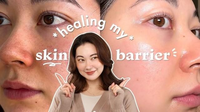 Xu hướng ‘skin barrier first’ khiến hội mê treatment cũng phải quay xe - Ảnh 2.