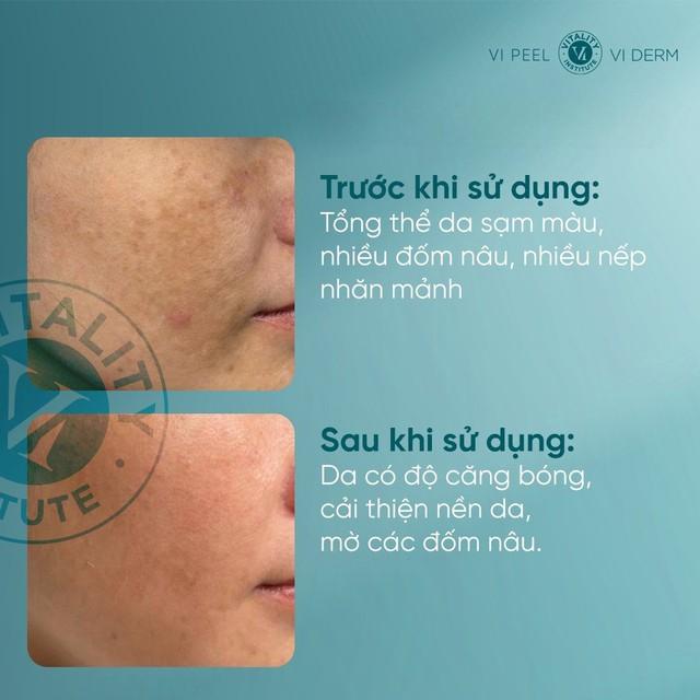 Top 5 retinol cho da lão hóa U.30+ ‘trẻ hóa’ tưởng như U.20 sau khoảng 4 tuần- Ảnh 4. Top 5 retinol cho da lão hóa U.30+ ‘trẻ hóa’ tưởng như U.20 sau khoảng 4 tuần- Ảnh 4.