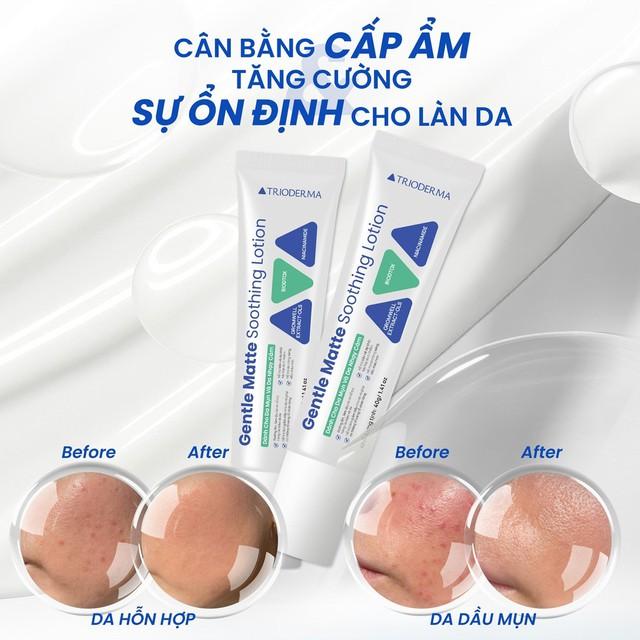 Xu hướng ‘skin barrier first’ khiến hội mê treatment cũng phải quay xe - Ảnh 7.