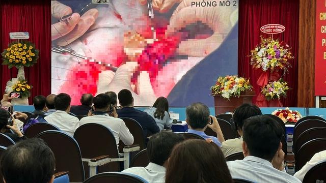 Mỗi tuần mổ 5 - 6 ca ung thư dương vật: Nỗi ám ảnh của đàn ông - Ảnh 2.
